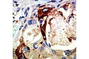 Image no. 3 for anti-V-Myb Myeloblastosis Viral Oncogene Homolog (Avian) (MYB) (AA 506-534) antibody (ABIN3029530)