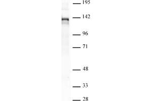Image no. 1 for anti-PHD Finger Protein 8 (PHF8) antibody (ABIN6972523)