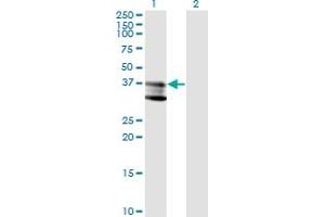 Image no. 1 for anti-Sphingomyelin phosphodiesterase 1, Acid Lysosomal (SMPD1) (AA 1-364) antibody (ABIN948483)