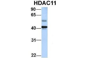 Image no. 2 for anti-Histone Deacetylase 11 (HDAC11) (Middle Region) antibody (ABIN2775577)