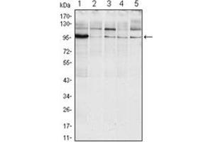 Image no. 1 for anti-Endoplasmic Reticulum To Nucleus Signaling 1 (ERN1) (AA 282-433) antibody (ABIN1107134)