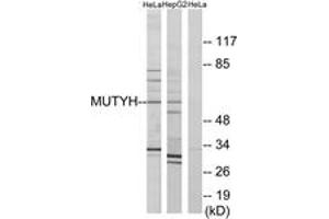 Image no. 1 for anti-MutY Homolog (E. Coli) (MUTYH) (AA 151-200) antibody (ABIN1534474)