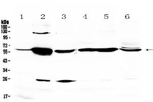 Image no. 1 for anti-Glycerol Kinase (GK) (AA 1-180) antibody (ABIN5692865)