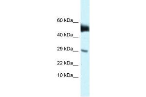 Image no. 1 for anti-Anti-Mullerian Hormone Receptor, Type II (AMHR2) (N-Term) antibody (ABIN2783792)