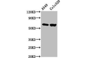 Western Blot Positive WB detected in: A549 whole cell lysate, Colo320 whole cell lysate All lanes: PDILT antibody at 4.
