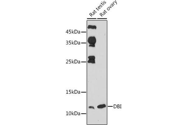 Diazepam Binding Inhibitor Antikörper  (AA 1-114)