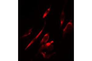 Image no. 1 for anti-Mitogen-Activated Protein Kinase 10 (MAPK10) antibody (ABIN6257975)