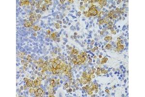 Immunohistochemistry of paraffin-embedded Rat spleen using FAS Polyclonal Antibody at dilution of 1:100 (40x lens).