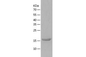 Fc gamma RII (CD32) (AA 34-216) protein (His tag)