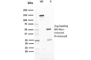 ERCC1 antibody  (AA 191-281)