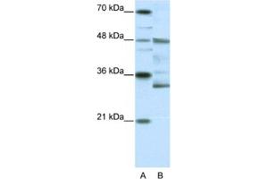 Image no. 1 for anti-Forkhead Box N2 (FOXN2) antibody (ABIN2461648)