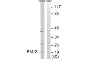 Image no. 1 for anti-Mitochondrial Ribosomal Protein L12 (MRPL12) (AA 31-80) antibody (ABIN1534517)
