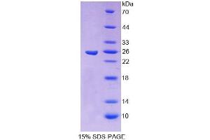 Image no. 1 for Core-Binding Factor, beta Subunit (CBFB) (AA 1-182) protein (T7 tag,His tag) (ABIN6238642)