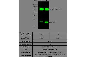 Image no. 2 for anti-CD3d Molecule, delta (CD3-TCR Complex) (CD3D) (AA 1-105) antibody (ABIN1997895)