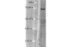 KCNQ1 Antikörper  (AA 2-101) (HRP)