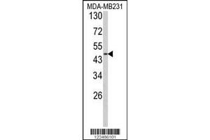 Image no. 1 for anti-Adrenergic, alpha-2B-, Receptor (ADRA2B) (Center) antibody (ABIN2157606)