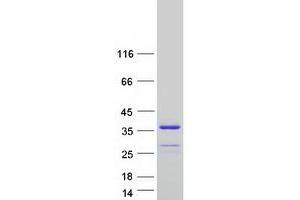 Image no. 1 for 5'-Nucleotidase, Cytosolic III-Like (NT5C3L) protein (Myc-DYKDDDDK Tag) (ABIN2727662)