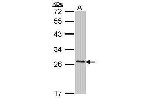 WB Image Sample (30 ug of whole cell lysate) A: Molt-4 , 12% SDS PAGE antibody diluted at 1:1000
