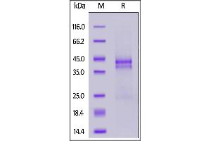 Image no. 2 for Connective Tissue Growth Factor (CTGF) (AA 27-349) protein (His tag) (ABIN6388270)
