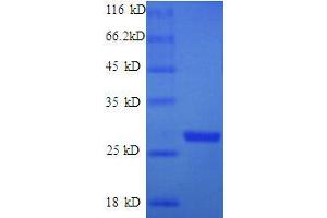 Thymidylate Kinase (Tmk) (AA 1-208) protein (His tag) expressed in E.