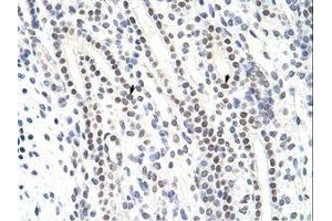 Image no. 1 for anti-Zinc Finger Protein 296 (ZNF296) (C-Term) antibody (ABIN6736191)