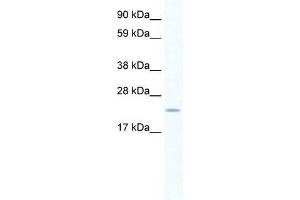 Image no. 1 for anti-SERTA Domain Containing 1 (SERTAD1) (N-Term) antibody (ABIN1108983)