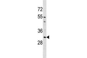 Image no. 2 for anti-Aquaporin 1 (Colton Blood Group) (AQP1) (AA 241-269) antibody (ABIN3030000)