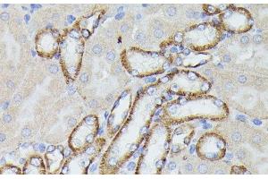 Immunohistochemistry of paraffin-embedded Mouse kidney using LTF Polyclonal Antibody at dilution of 1:100 (40x lens).