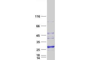 Image no. 1 for Lysophospholipase-Like Protein 1 (LYPLAL1) protein (Myc-DYKDDDDK Tag) (ABIN2725048)