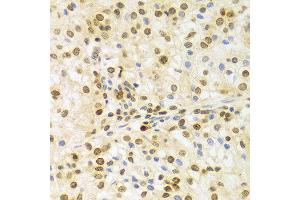 Image no. 24 for anti-ELAV (Embryonic Lethal, Abnormal Vision, Drosophila)-Like 1 (Hu Antigen R) (ELAVL1) antibody (ABIN3022231)
