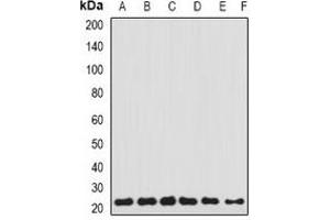 Image no. 2 for anti-Transgelin 2 (TAGLN2) antibody (ABIN2967110)
