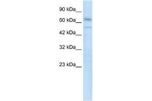 WB Suggested Anti-ZNF306 Antibody Titration:  0.