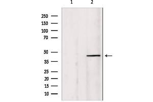 Image no. 3 for anti-Protein Inhibitor of Activated STAT, 1 (PIAS1) (N-Term) antibody (ABIN6264195)