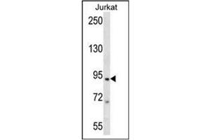 Image no. 2 for anti-Transporter 1, ATP-Binding Cassette, Sub-Family B (MDR/TAP) (TAP1) (AA 773-802), (C-Term) antibody (ABIN1449427)