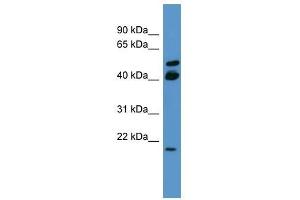 Image no. 1 for anti-RAS-Like, Estrogen-Regulated, Growth Inhibitor (RERG) (C-Term) antibody (ABIN929304)