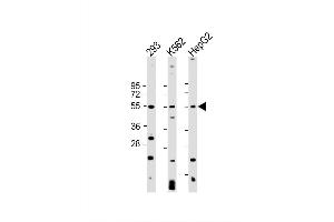 Image no. 5 for anti-Vascular Endothelial Growth Factor C (VEGFC) antibody (ABIN650694)