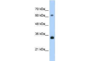 Image no. 4 for anti-Proliferating Cell Nuclear Antigen (PCNA) (C-Term) antibody (ABIN2792157)