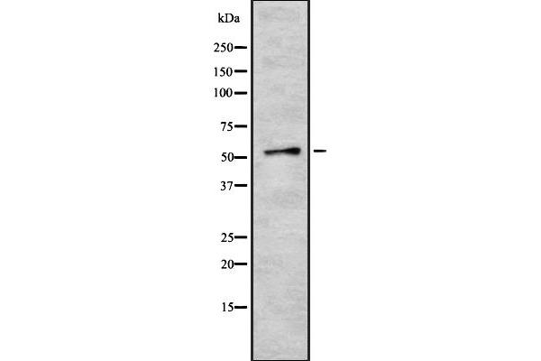 anti-Zinc Finger Protein 768 (ZNF768) (Internal Region) antibody