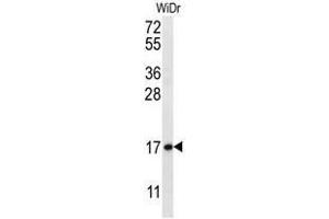 Image no. 1 for anti-Tubulin Folding Cofactor A (TBCA) (AA 14-44), (N-Term) antibody (ABIN955100)