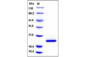 Image no. 1 for Cyclophilin B (PPIB) (AA 34-212), (Mature) protein (His tag) (ABIN2003709)