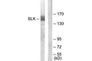 Image no. 3 for anti-STE20-Like Kinase (SLK) (AA 1151-1200) antibody (ABIN1534120)