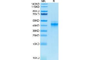 IL12 Protein (His-Avi Tag,Biotin)