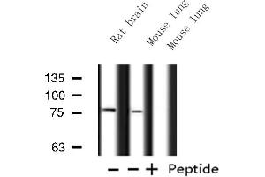 Image no. 1 for anti-Ataxin 7-Like 2 (ATXN7L2) antibody (ABIN6258382)