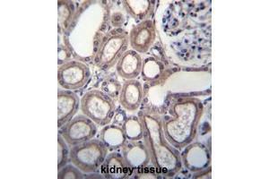 Image no. 1 for anti-Ring Finger Protein 180 (RNF180) (AA 408-438), (C-Term) antibody (ABIN954568)