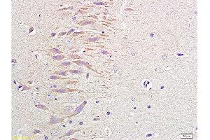 Image no. 2 for anti-Neuropeptide Y (NPY) (AA 29-64) antibody (ABIN724475)