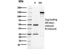 Image no. 1 for anti-Keratin 5 (KRT5) (AA 316-590) antibody (ABIN6939864)