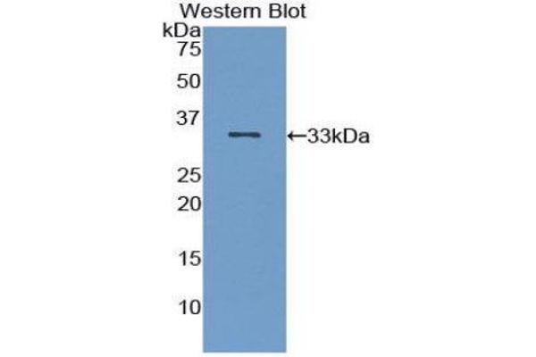 anti-Interleukin-1 Receptor-Associated Kinase 2 (IRAK2) (AA 235-521) antibody