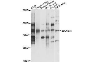 Image no. 1 for anti-Solute Carrier Organic Anion Transporter Family, Member 3A1 (SLCO3A1) antibody (ABIN6293704)
