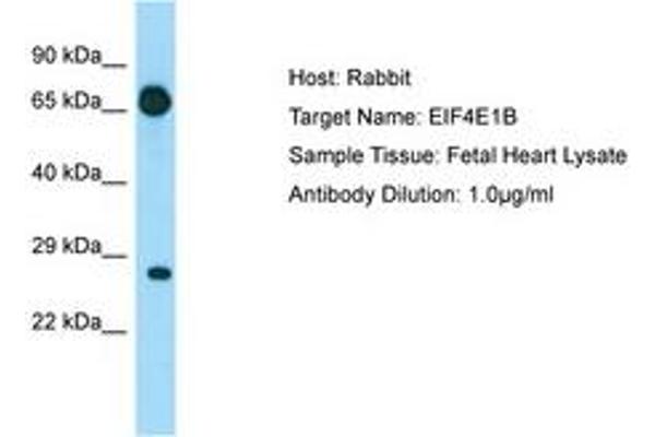 EIF4E1B 抗体  (AA 20-69)