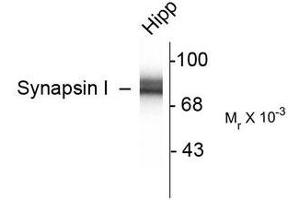Image no. 2 for anti-Synapsin I (SYN1) antibody (ABIN372716)